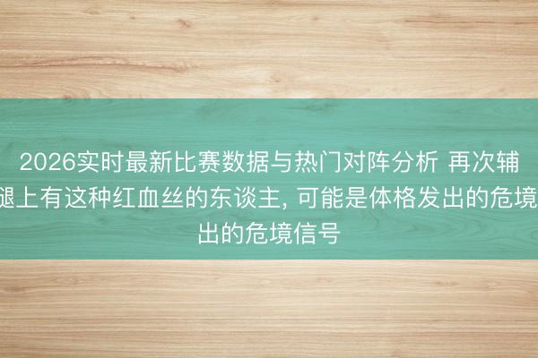 2026实时最新比赛数据与热门对阵分析 再次辅导: 腿上有这种红血丝的东谈主, 可能是体格发出的危境信号